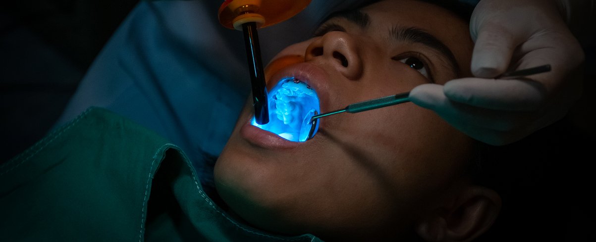Laser Dentistry