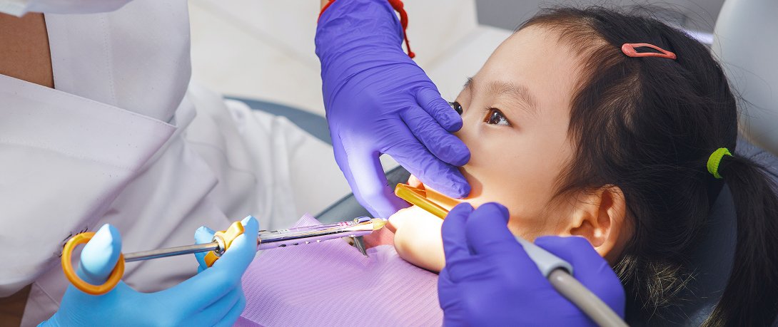 Root Canal Treatment